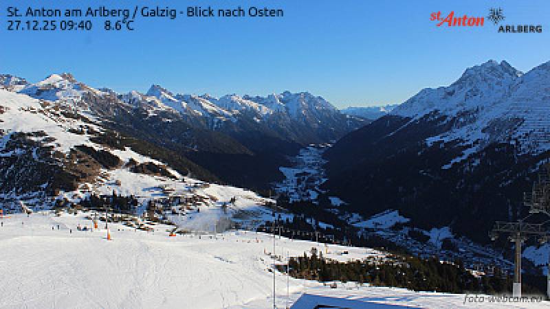 Webcam St. Anton Galzig