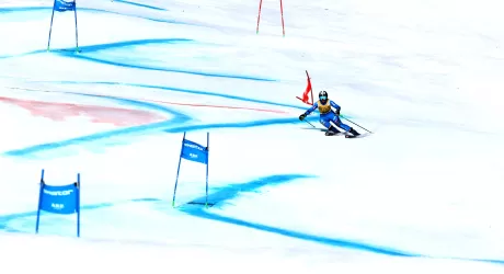 Are, Scheib gigante e coppetta, Zenere decima